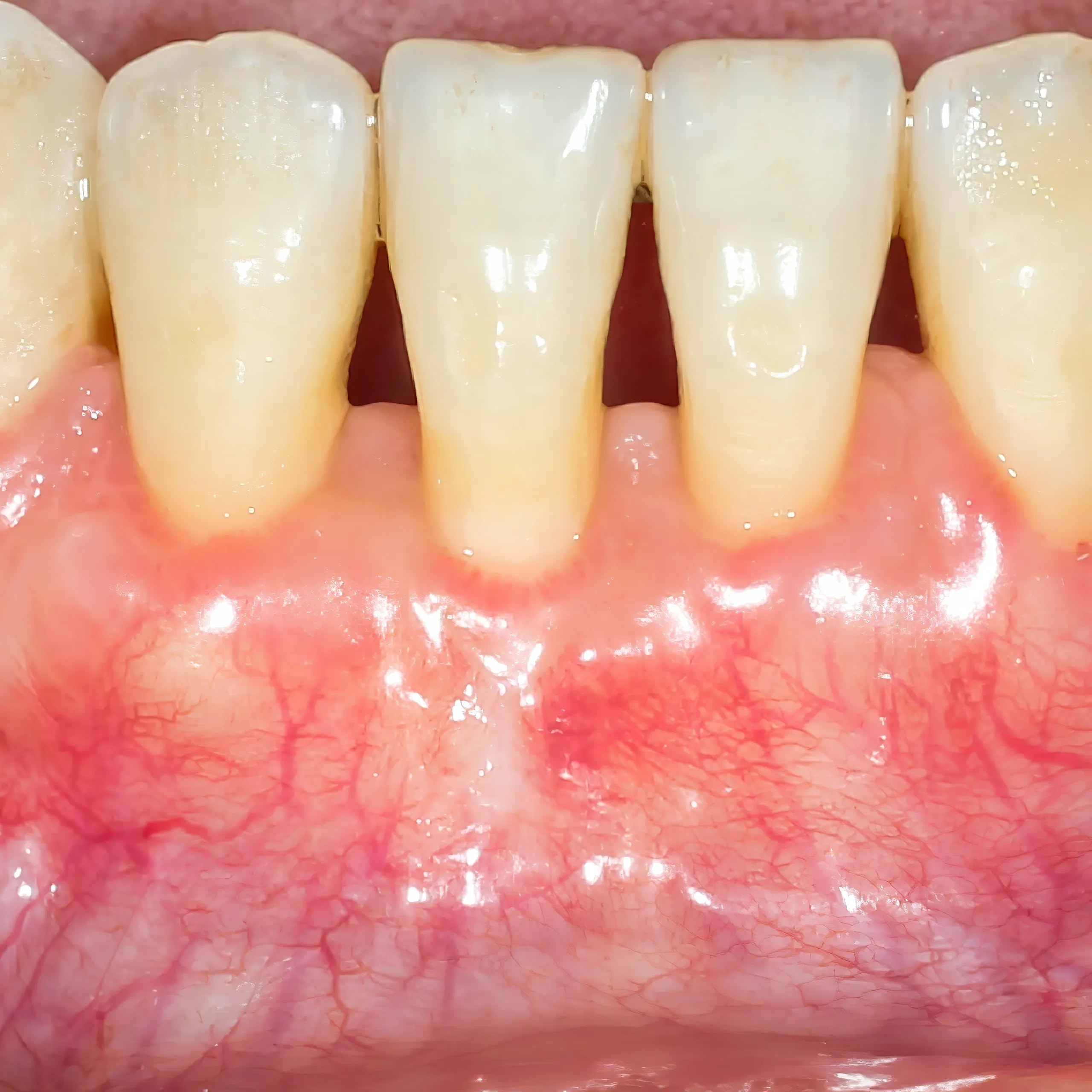 Periodontics